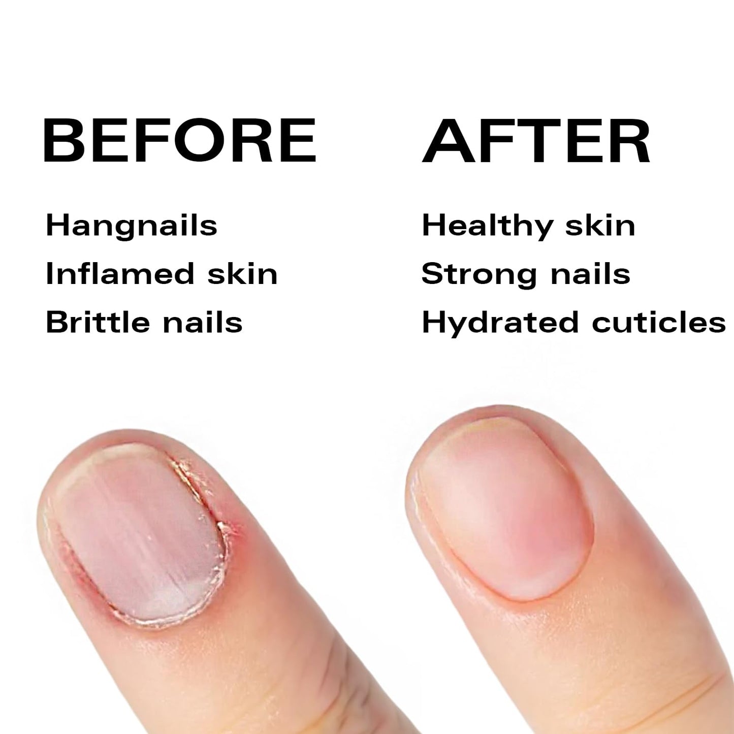 Manicure Pedicure Set 7-1 & Pineapple Cuticle Oil Pen for Free Bundle, Stainless Steel, Ultra Sharp, Slanted Nail Clipper, Fingernail Clipper, Cuticle Nipper, Glass Nail File, Eyebrow Tweezers