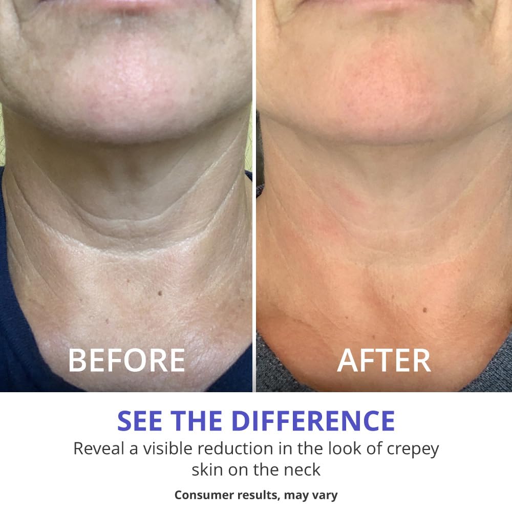 goPure Tighten and Lift Neck Cream - Clinically Tested - Pack of 2
