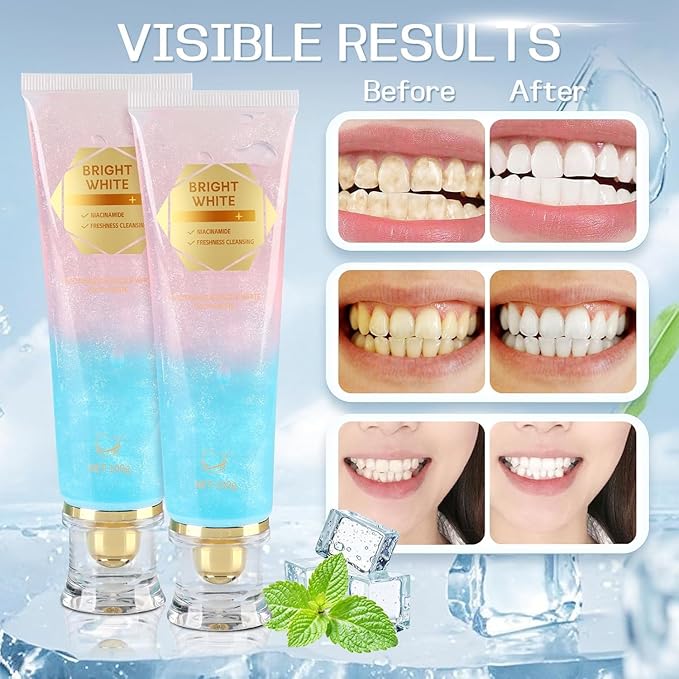 2PC Niacinamide Whitening Toothpaste, Niacinamide Intensive Whiten-ing Toothpaste, Triple Whitening Niacinamides Intensive Toothpastes, Gentle Mint, Fresh Breath, Remove Tooth Stains