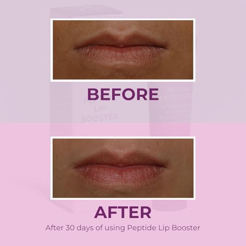 Alchimie Forever Lip Booster, Peptide-Power Plumping Formula for Hydrating Lip Treatment with Volulip & Maxilip by Sederma, Shea Butter, and Jojoba Oil – Vegan Balm for Dry Lips – 0.3 FL Oz