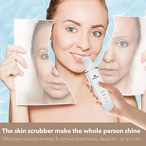 Skin Scrubber Face Skin Spatula Facial Scrubber Spatula for Deep Cleansing Blackhead Remover Pore Cleaner with 4 Modes (White) - color: White