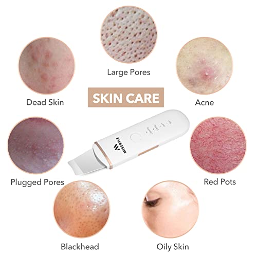 Skin Scrubber Face Skin Spatula Facial Scrubber Spatula for Deep Cleansing Blackhead Remover Pore Cleaner with 4 Modes (White) - color: White