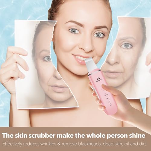Skin Scrubber Face Skin Spatula Facial Scrubber Spatula Pore Cleaner with 4 Modes (Pink) - color: Pink