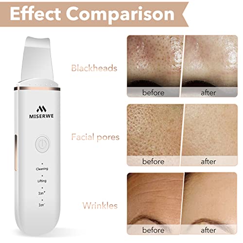 Skin Scrubber Face Skin Spatula Facial Scrubber Spatula for Deep Cleansing Blackhead Remover Pore Cleaner with 4 Modes (White) - color: White