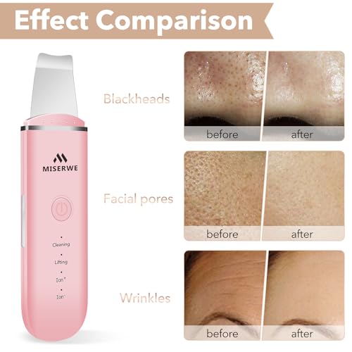 Skin Scrubber Face Skin Spatula Facial Scrubber Spatula Pore Cleaner with 4 Modes (Pink) - color: Pink