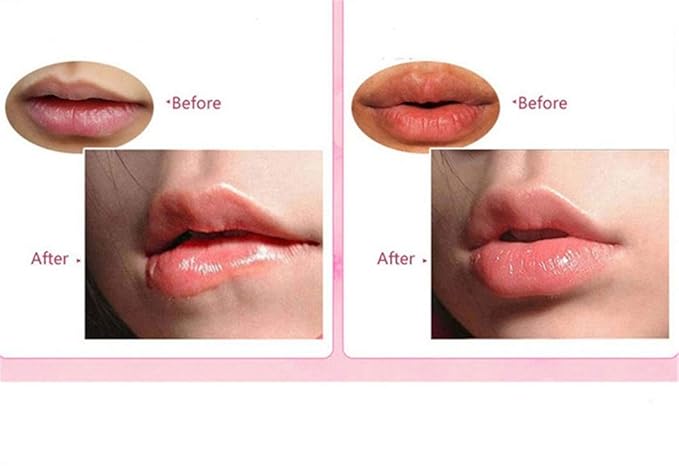 30PCS Collagen Lip Mask,Crystal Moisturizing Lip Mask Sheet Lip Patches for Dry Lips & Anti-Chapped, Lip Care Pads, Plumping Your Lip, Rose Pink