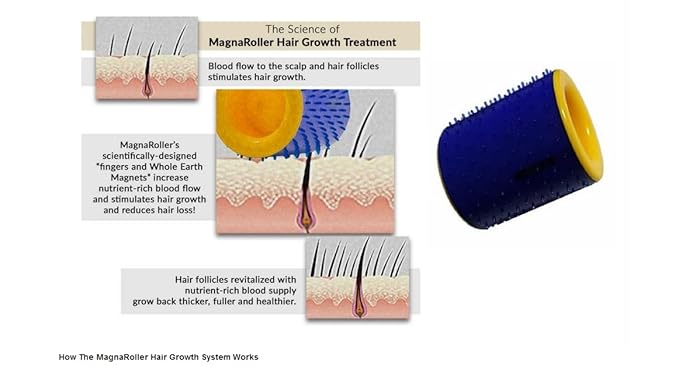 MagnaRoller Scalp Massager for Hair Growth - Hair Loss Treatment for Men and Women with Thinning, Dry and Dull Hair - Increases Blood Flow to Scalp & Hair follicles for Thicker, Healthier Hair.