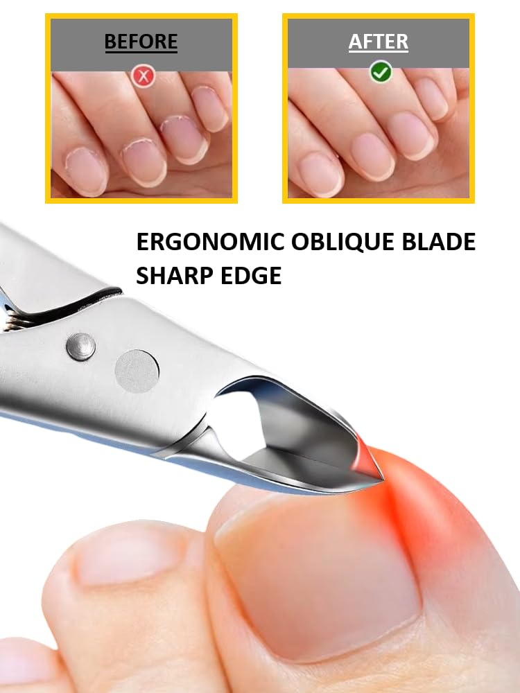 Germany - Apexay Cuticle Nippers -Stainless Steel Cuticle Clippers with Built-in spring Design, Ultra-Sharp Precision Blades for Manicure, Pedicure & Dead Skin Removal (Grey)