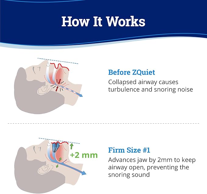 ZQuiet, Anti-Snoring Mouthpiece, Firm Size #1, Strong & Durable Mouthguard, Ideal for Those Prone to Teeth Grinding & Clenching, Made in USA, Size 1