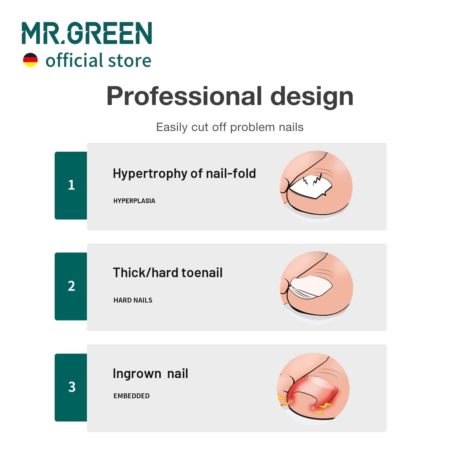 MR.GREEN Toenail Clippers Stainless Steel Ingrown Nail Cutter Thick and Hard Nails Pedicure Manicure Tools (Orange)