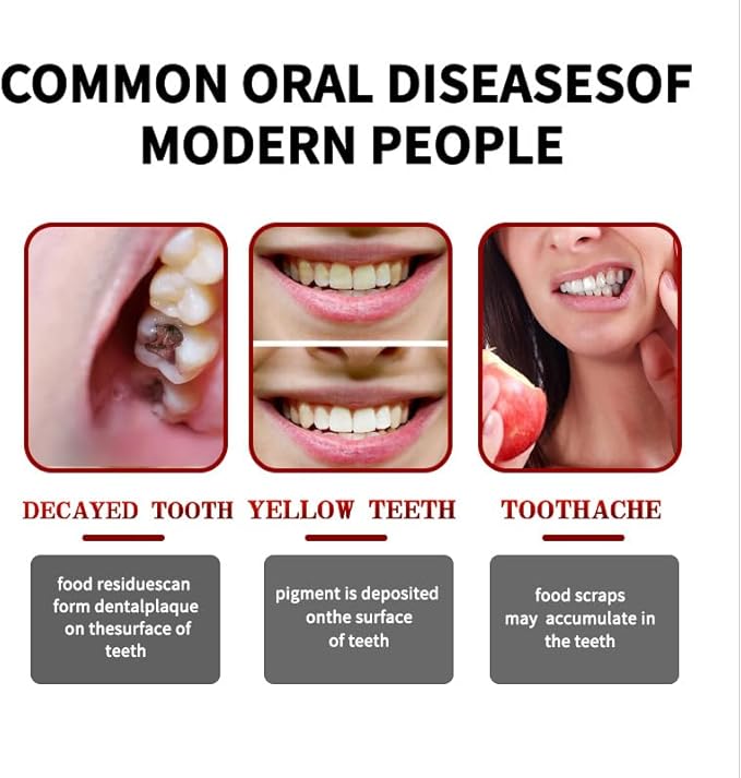 SP-8 Ultra Whitening Probiotics Toothpaste, Fresh Breath Deep Cleaning Care Oral Health.(1Pcs)