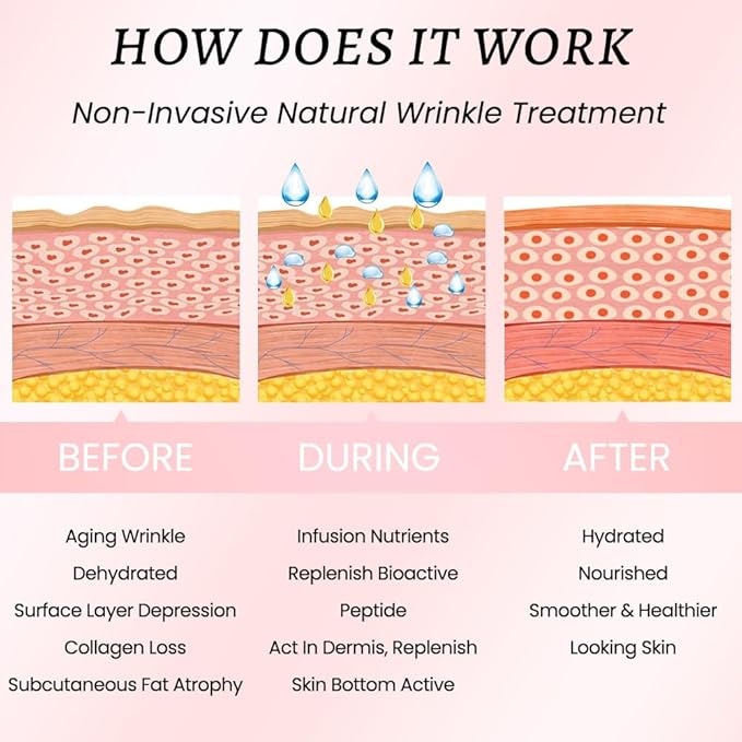 Kaely Wrinkle Patches for Face Overnight, Silicone Scar Tape for Wrinkles Forehead, Smile Line, Face Tape for Wrinkles Overnight Sleeping Lifting Sagging Skin, 256 Pcs (16 Sheets of 16 Patches)