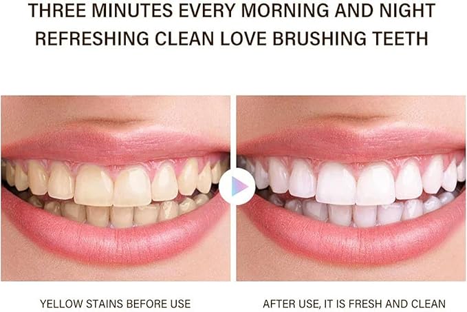 Probiotic Whitening Toothpaste, Utogur Toothpaste, Niacinamide Whitening Toothpastes, Effectively Whitens Teeth, Natural Gentle Remove Tooth Stains (1)