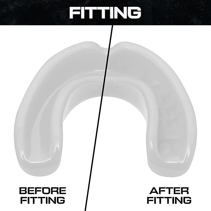 Sports Mouth Guard for Kids,Youth,Boys,Girls,Child Teen Mouthguard with Case (BPA Free) for Boxing, Martial Arts,MMA Karate,Lacrosse,Football,Soccer and All Contact Sports (White)