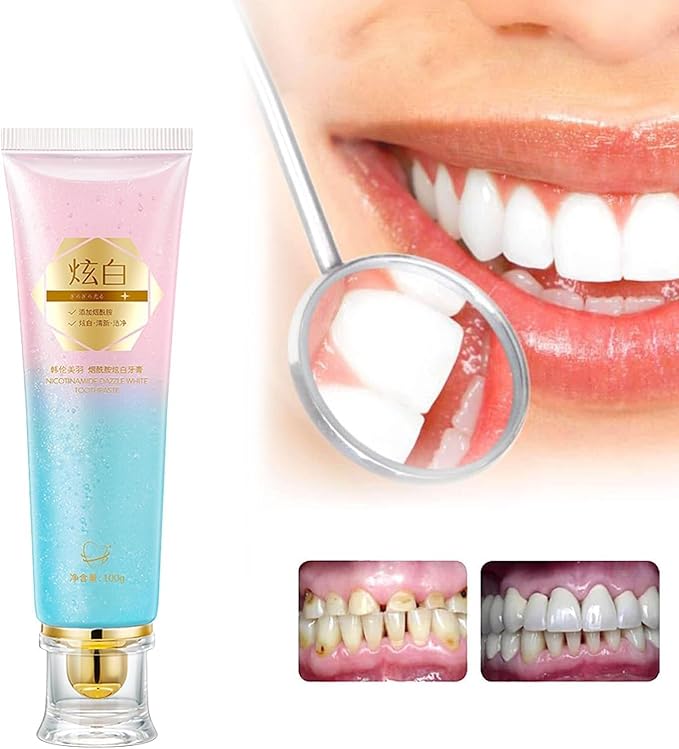 2Pcs Acssart Radiant Whitening Toothpaste,Niacinamide Whitening Toothpastes, Fresh Breath Stain Removal