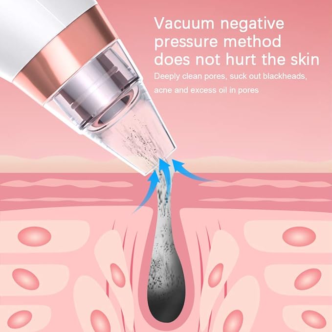 Yafei Pore Vacuum Removed Blackheads 2021 Upgraded Strong Suction Rechargeable Removing Black Heads USB Rechargeable Blackhead Removal Pimple for Women & Men Gray