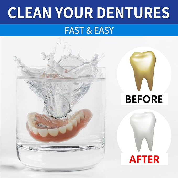 Dental Retainer Cleaner Tablets, 100 Count, 3 Minute Action, Whitening Formula for Dentures and Mouthguards