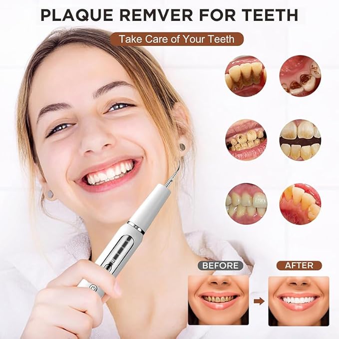 Plaque Remover for Teeth, Tartar Remover for Teeth, Rechargeable Electric Tartar Scraper with 3 Modes and Smart Protection, IPX7 Waterproof Dental Cleaning Kit with Tongue Cleaner (White)