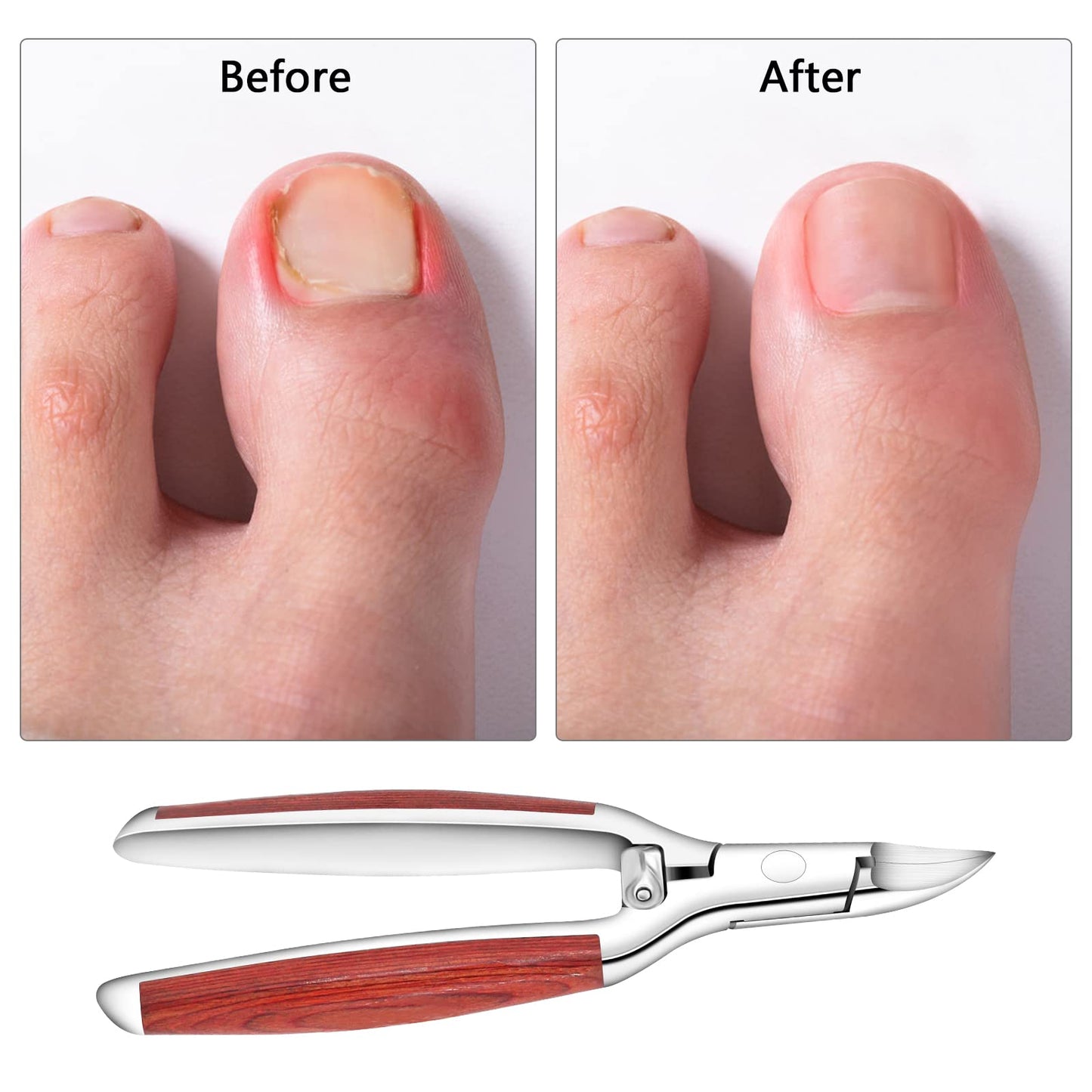 Nail Clipper,Toenail Clippers for Thick and Ingrown Nails,Heavy Duty Podiatrist Toenail Nippers for Seniors Fingernails,Toenails Pedicure,Wooden Handle,Sharp Blade