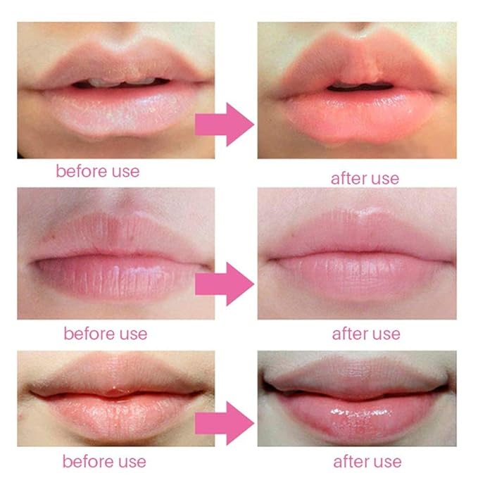 30 PCS Pink Crystal Collagen Hydrogel Lip Mask Set, Moisturizing and Hydrating Lip Plumper Gel Pads for Dry Lips, Make Your Lip Attractive and Sexy (Peach Scent)