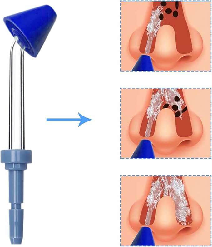 Nose Washing Compatible with Waterpik Oral irrigator WP-100 WP-450 WP-250 WP-300 WP-660 WP-900 (6-Pack)