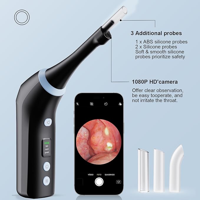 Electronic Tonsil Stone Remover with Camera, Tonsil Stone Removal Kit, 3 Suction Levels, Tonsil Stone Vacuum, Oral Care for Mouth Health, USB Rechargeable (Black)
