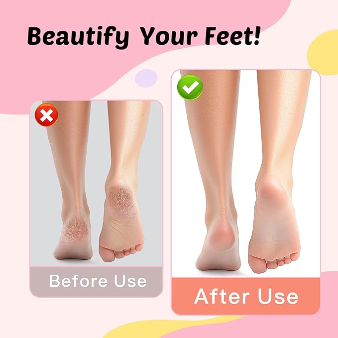 Electric Foot Callus Remover - 9-Speed Rechargeable Pedicure Tool with 20pcs 80/120 Grit Sandpapers +10 Grinding Heads | Aluminum Body & Type-C Charging (Black)