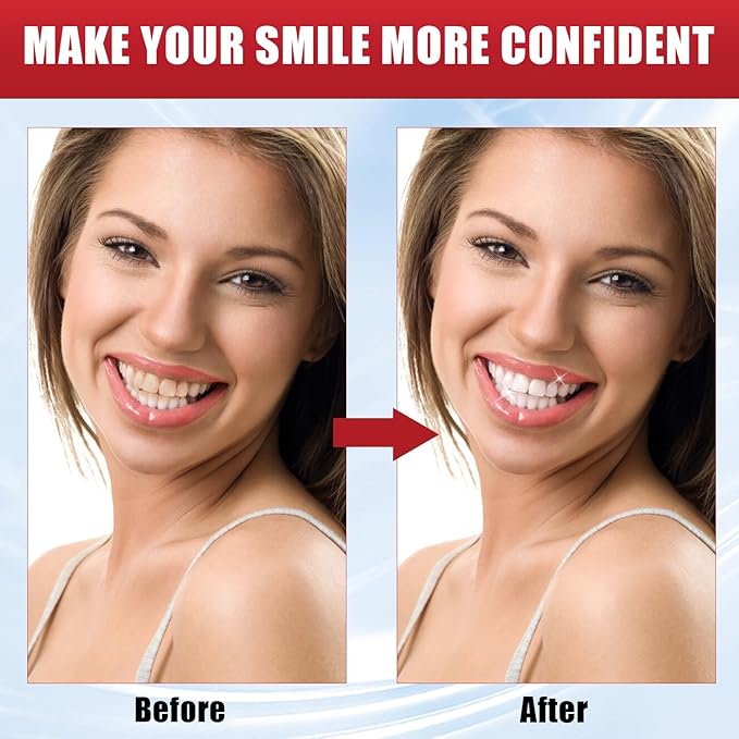 Super ProbioticSp-8 Toothpaste, Sp 8 Pasta Dental, SP-8 Toothpaste, Pasta Dental Sp-8,SP8 Probiotic Toothpaste, Deep Cleaning Care Toothpaste