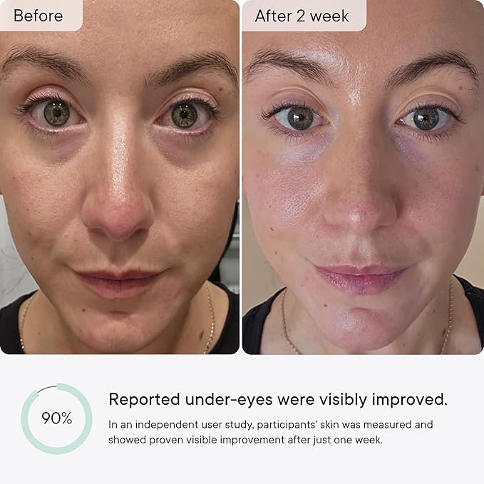 Qure Micro-Infusion Anti Wrinkle Patches for Smile Line, Frown lines, Under Eye Bags, Puffiness, Crow's Feet - Retinol, Caffeine, Peptides - Dissolvable for Overnight Use - 8 Pairs