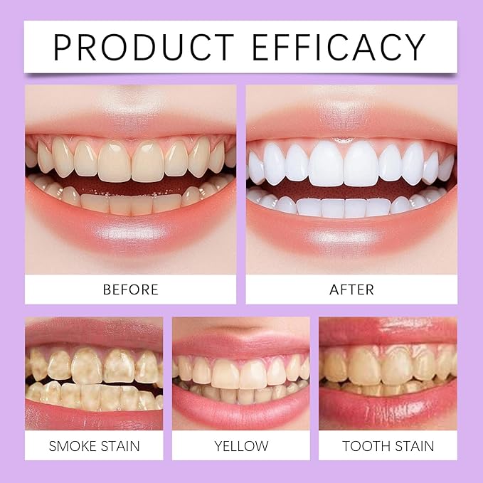 2025 New Whitening Purple Toothpaste,3X White Brilliance Toothpaste, Fluoride-Free Teeth Whitening,Tooth Stain Removal Colour Corrector (1)