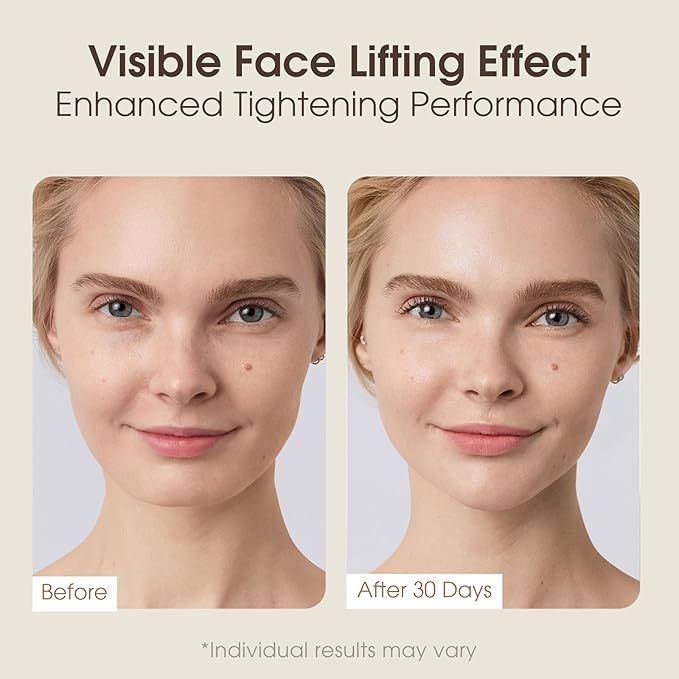 Intelligent Double Chin Reducer and V-Face Lift Belt Machine with Remote Control, Face Massager V-Face Device for Women