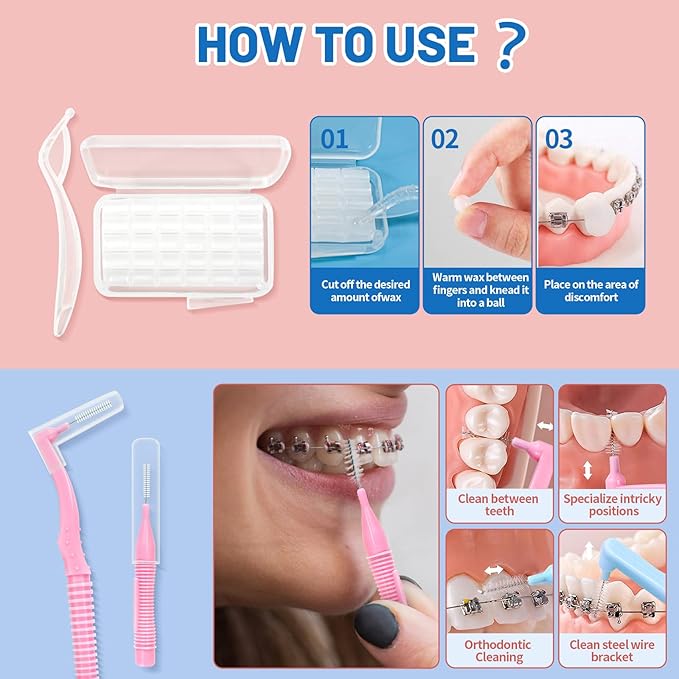 Orthodontic Care Travel Kit | V-Shape Toothbrush with Soft Bristles, Interdental Brushes, Orthodontic Wax, and Breathable Case | Portable Dental Kit for Braces and Aligners(PINK)