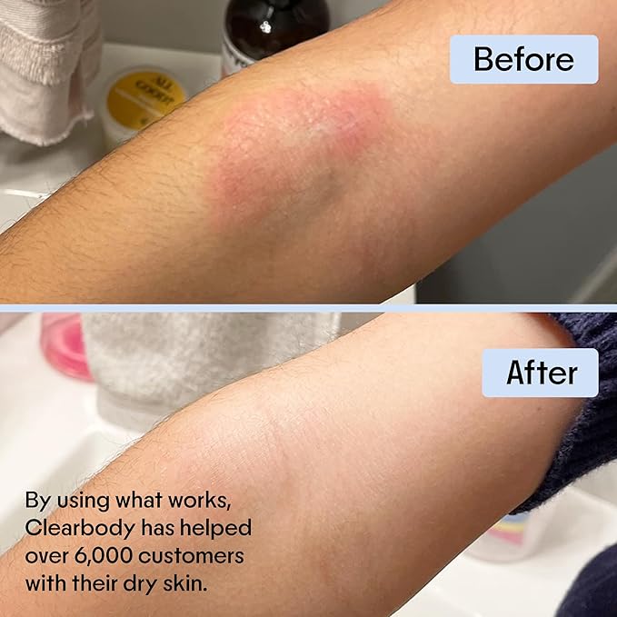 Clearbody Organics Oatmeal Lotion - 4 Fl Oz - Eczema Cream & Treatment - Natural Ointment for Eczema Manuka Honey Hydration Body Lotion