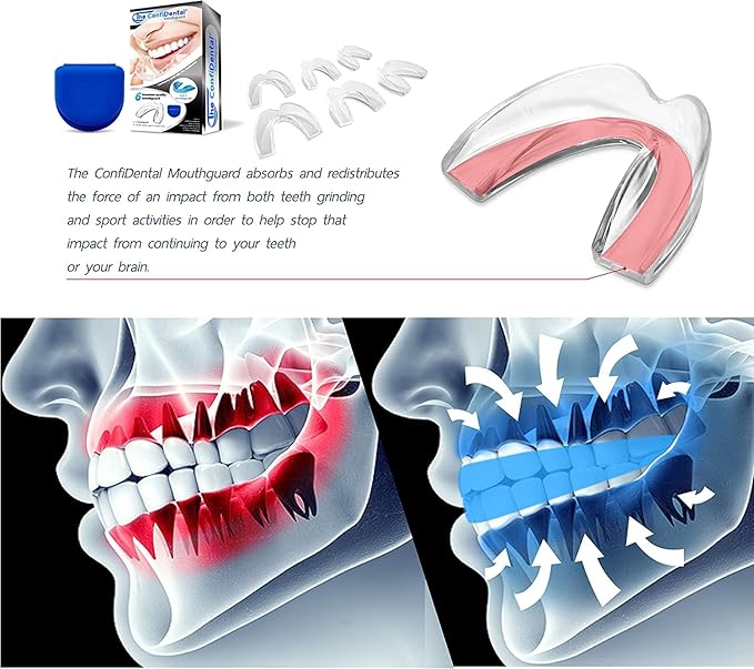 The ConfiDental Mouth Guard for Grinding Teeth at Nighttime Pack of 6 Moldable Dental Bite Guards for Clenching and Bruxism, Custom Fit for Comfortable Sleep
