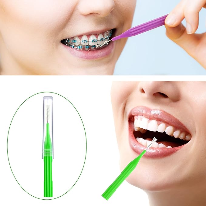 Patelai 50 Pieces Braces Brush for Cleaner Interdental Brush Between Teeth Toothpick Flosses Dental Flossing Head Oral Hygiene Tooth Cleaning Tool(Assorted Color)