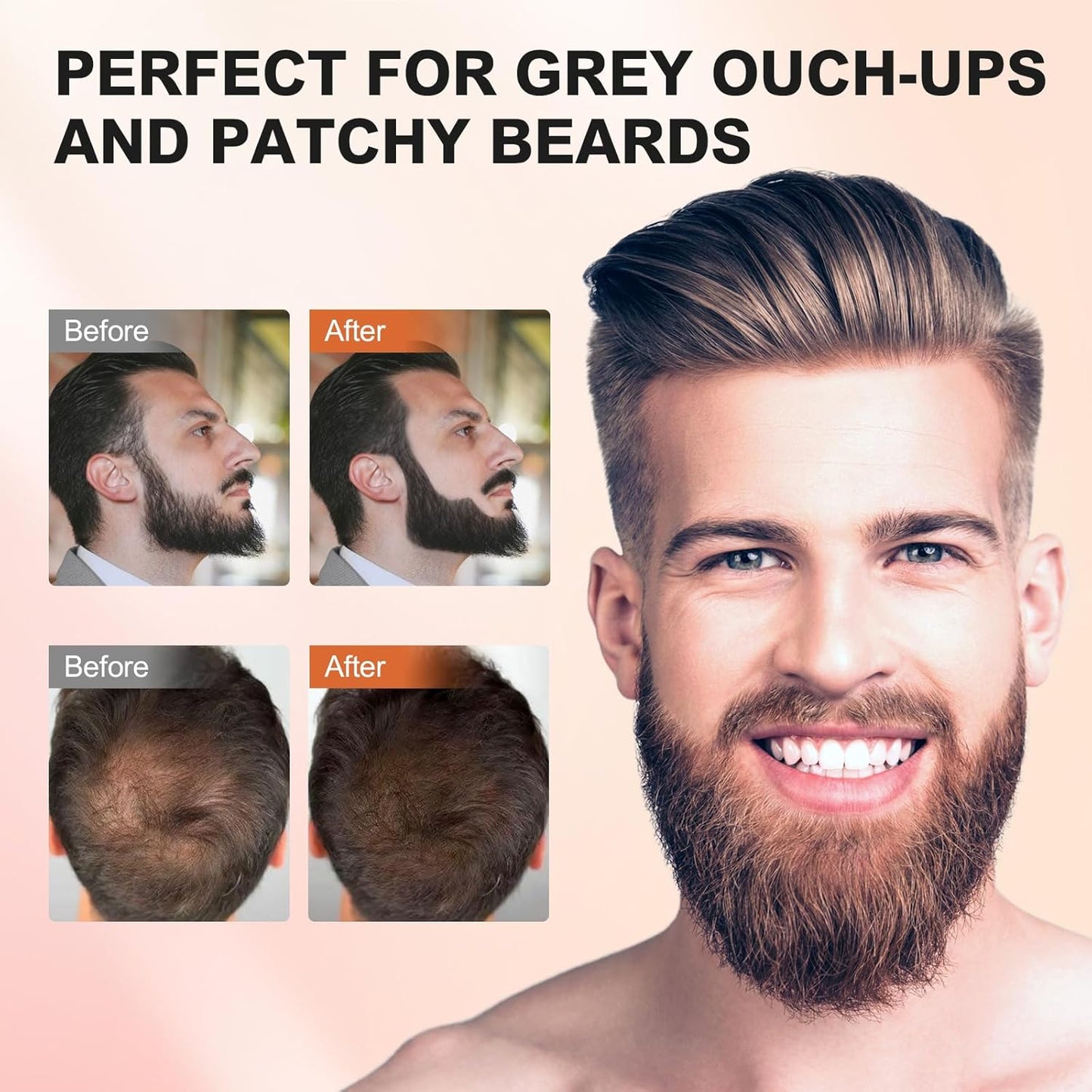 Root Touch Up Powder, Hairline Shadow Concealer for Women's Eyebrows and Men's Beard Lines, Covers Bald Spots (Medium Brown)