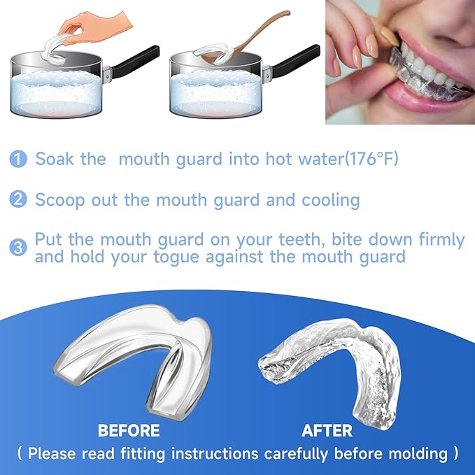 4 Pack Blue Mouth Guards for Women and Men, Large Size, Moldable Night Guards for Teeth Grinding and Clenching, Comfortable Bite Guards, Stylish Custom Dental Guards for Protection