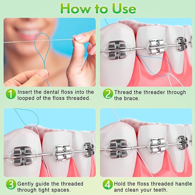 Floss Threaders, Orthodontic Threader, Ultraclean Access Tool for Maintaining Oral Health with Braces, Bridges, and Implants 300 Count (Pack of 3)