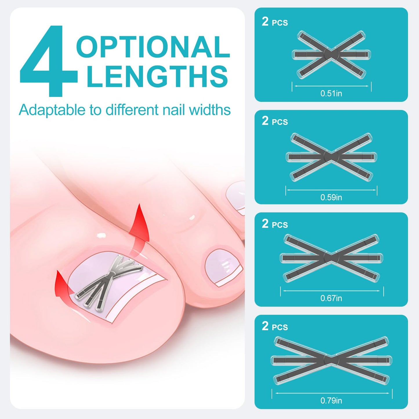 Ingrown Toenail Treatment Kit with Upgraded 6-Angle Shape,Titanium Alloy Ingrown Nail Corrector Tools with 4 Multi-Sizes,Ingrown Toe Nail Relief Remover Strips for Curved Toenail Quick Relief,8Pcs