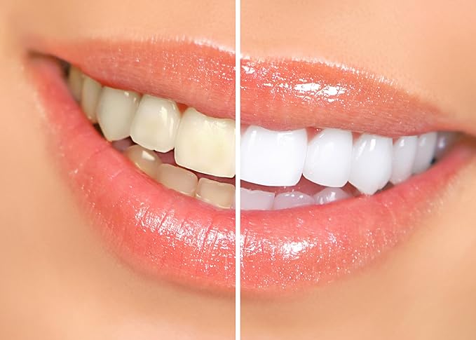 Dr. George's Dental Whitening Gel with Instructions