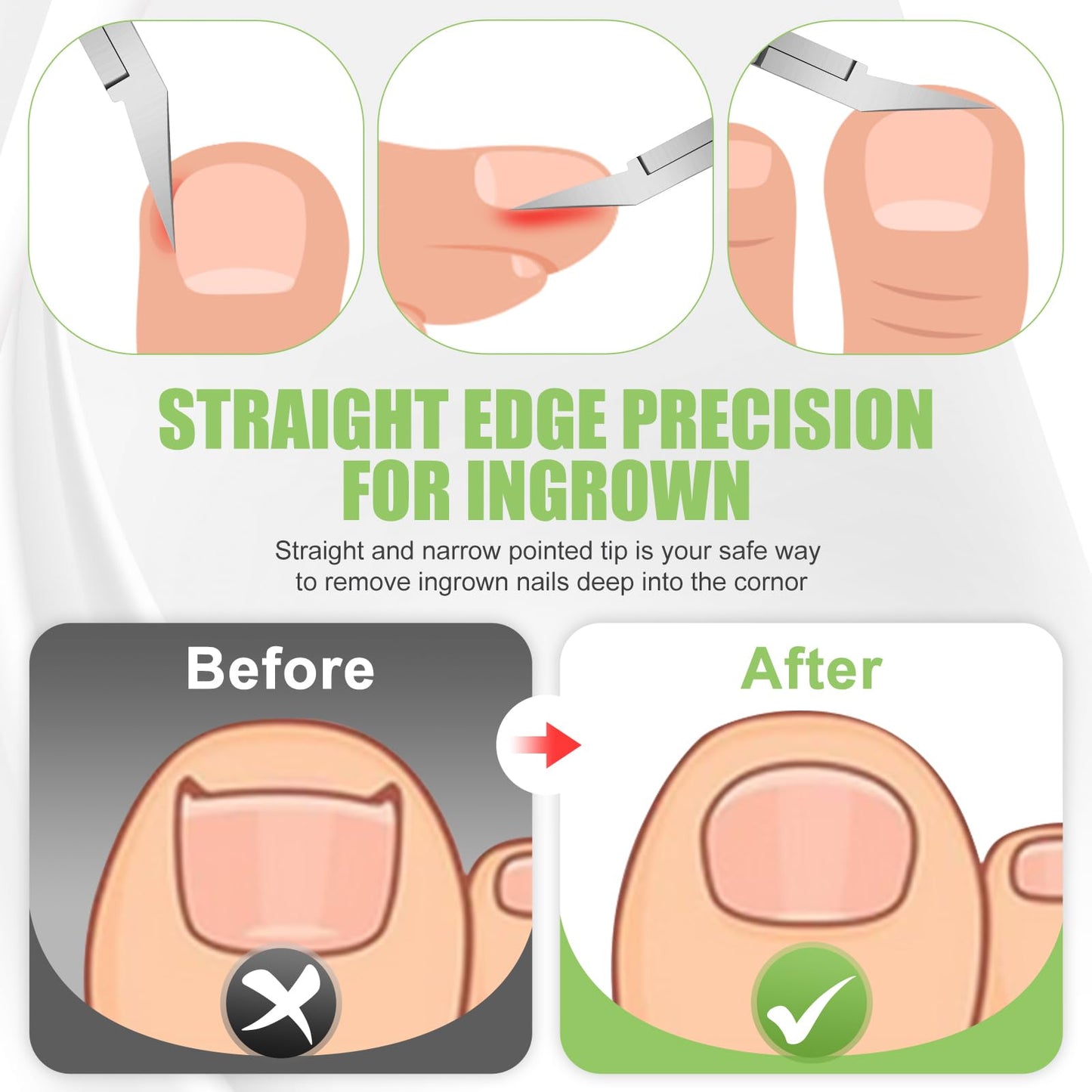 Ingrown Toenail Clippers for Thick Toe Nails, Straight Nail Clippers for Men, Heavy Duty Toe Nail Clippers with Soft Handle, Ultra Sharp Stainless Steel Fingernail Clippers with PU Leather Pouch