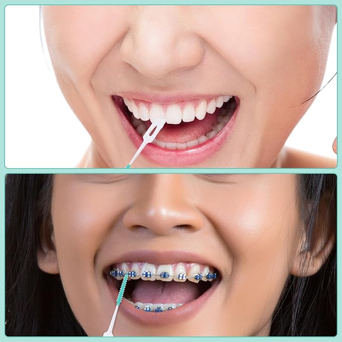 160 Pieces Dual Purpose, Dual-Use Interdental Brushes Silicone Disposable Dental, Premium Dental Floss 360° Bendable Braces Brush Brushes for Effective Teeth Cleaning