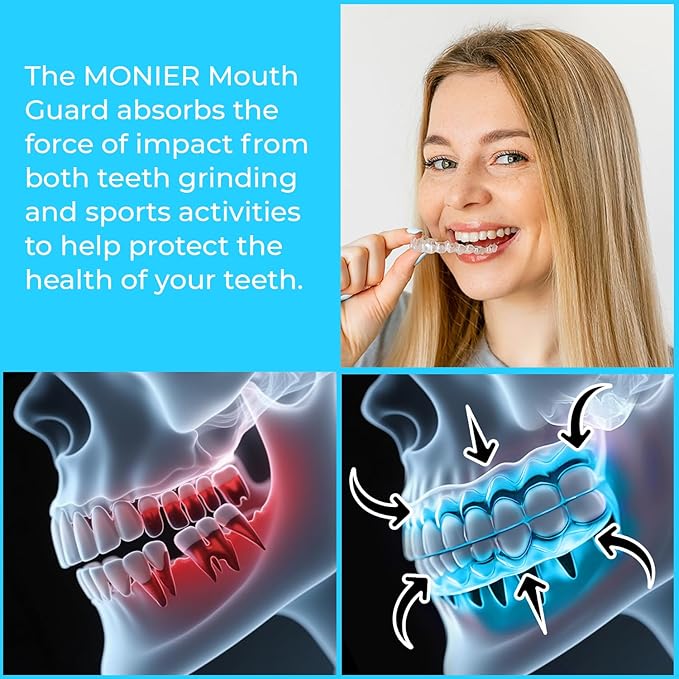 Mouth Guard for Grinding Teeth at Night | Dental Night Guard for Clenching & Better Sleep | 4 Moldable Mouthguards with 12 Cleansing Tablets