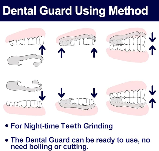 Kids Mouth Guard for Grinding and Clenching Teeth with Portable Hygiene Case | BPA Free, Disposable & Ready to Use - No Need to Boil/Mold | Comfort-fit Mouth Night Guard 10 Count