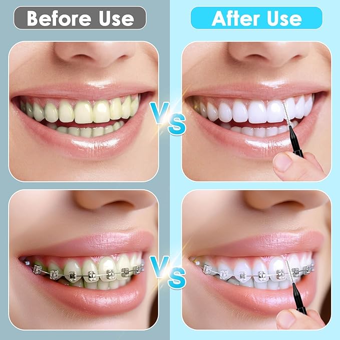270Pcs Interdental Brush, 220Pcs Soft Dental Picks & 50Pcs Braces Brush for Teeth, Bendable Braces Flossers Heads Interdental Brushes Between Teeth Oral Tooth Braces Cleaner Kit (Black)