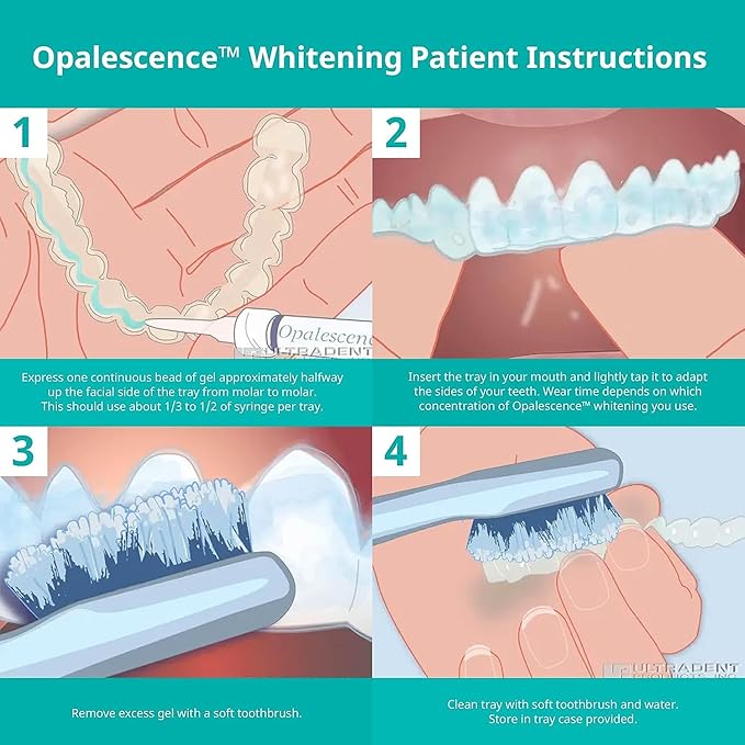 Opalescence 35% with PF Gel Syringes Teeth Whitening - (8 Syringes) Refill Kit Carbamide Peroxide. Made by Ultradent, in Melon Flavor. Tooth Whitening Refill Syringes 5404-4