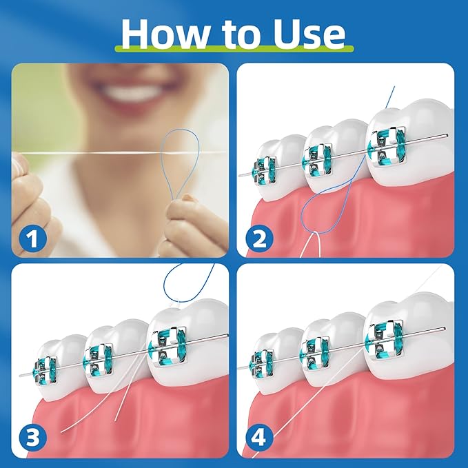 RioRand Floss Threaders,Essential Tool for Maintaining Oral Health with Braces, Bridges, and Implants 150 Count (Pack of 3)