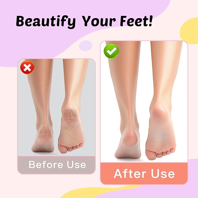 Electric Foot Callus Remover - 9-Speed Rechargeable Pedicure Tool with 20pcs 80/120 Grit Sandpapers +10 Grinding Heads | Aluminum Body & Type-C Charging (Purple)