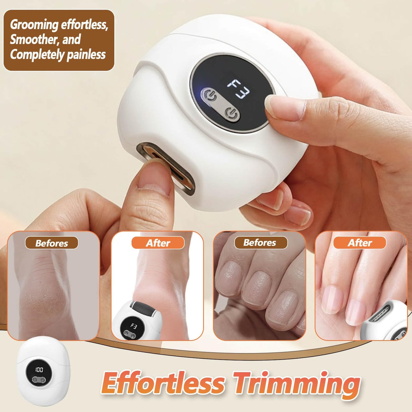 3 in 1 Electric Nail Clippers,Nail Trimmer with Cocoon Removing Function,Nail Scraps Storage,Nail Care Tool with 3 Adjustable Speeds,Automatic Electric Toenail Clippers for Seniors,Kids,Adults (White)