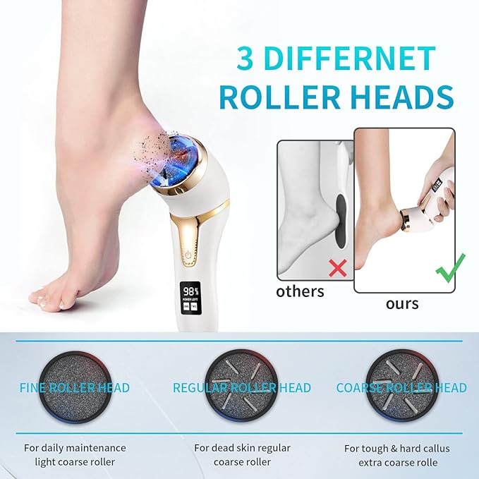Electric Foot Callus Remover with Vacuum,AMPK Professional Pedicure Tools Kit Foot File Scraper,Waterproof Callus Remover Kit with 3Heads,2Speed,Battery Display for Callused Dead Hard Cracked Dry Skin